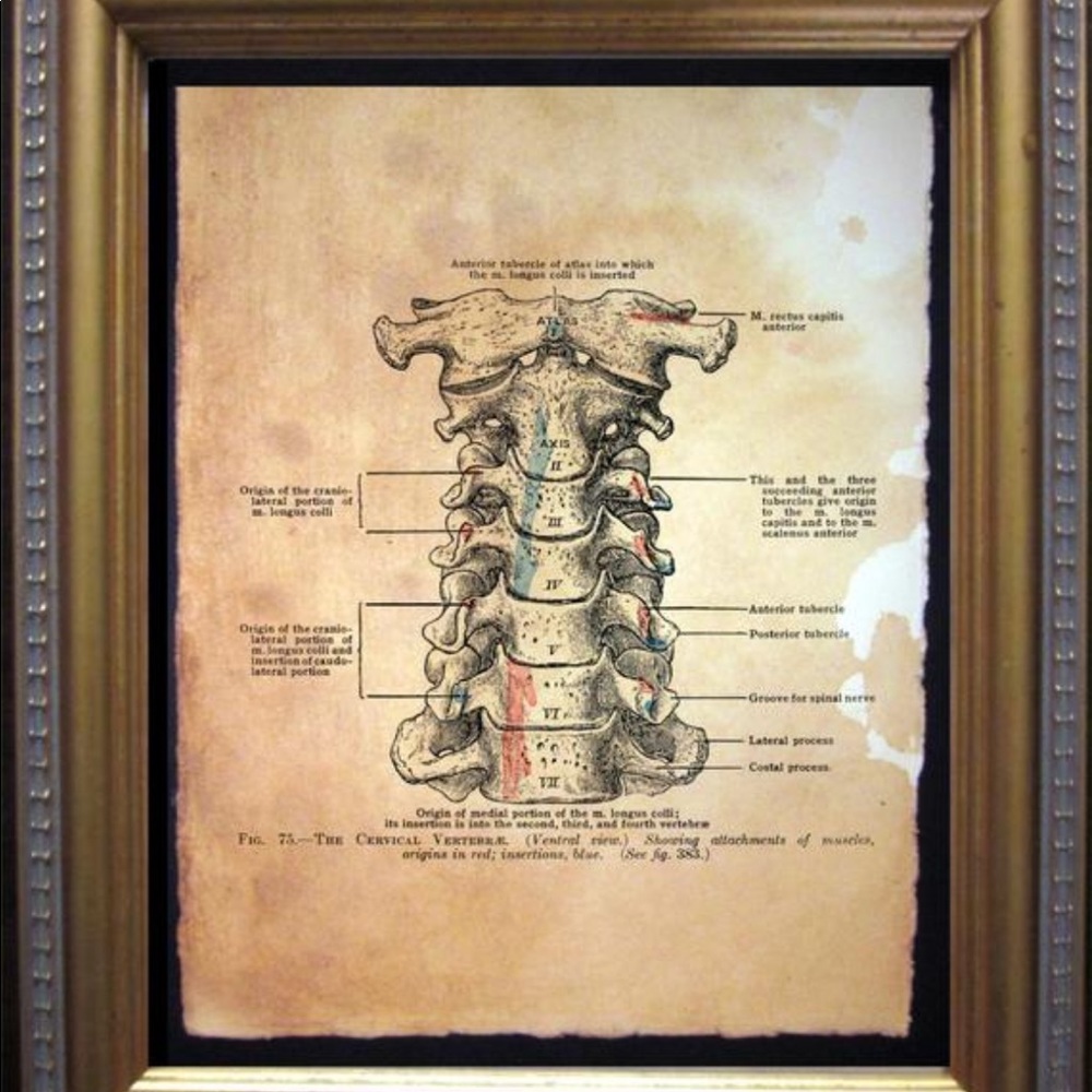 Vintage Cervical Vertebrae Art Print Tea Stained